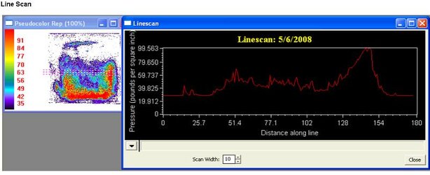 26Alinescan75%.JPG